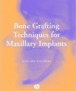 Bone Grafting Techniques for Maxillary Implants 1st Edition
