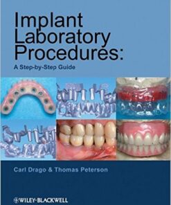 Implant Laboratory Procedures: A Step-by-Step Guide 1st Edition