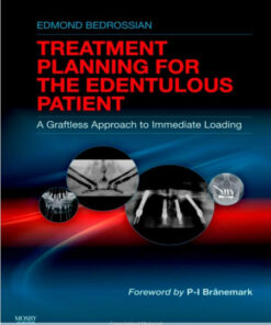 Implant Treatment Planning for the Edentulous Patient: A Graftless Approach to Immediate Loading, 1e 1st Edition