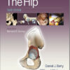 Master Techniques in Orthopaedic Surgery The Hip Third Edition