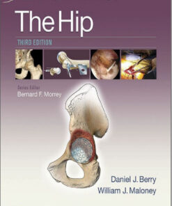 Master Techniques in Orthopaedic Surgery The Hip Third Edition