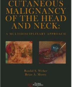 Cutaneous Malignancy of the Head and Neck: A Multidisciplinary Approach 1st Edition