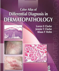 Color Atlas of Differential Diagnosis in Dermatopathology 1st Edition