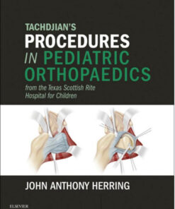 Tachdjian's Procedures in Pediatric Orthopaedics: From the Texas Scottish Rite Hospital for Children, 1e