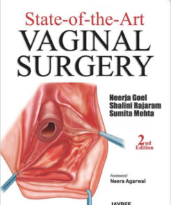 State-of-the-Art Vaginal Surgery 2  Edition