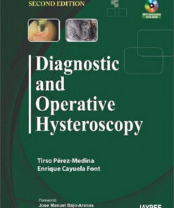 Diagnostic and Operative Hysteroscopy 2nd (second) Revised Edition
