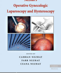 Nezhat's Operative Gynecologic Laparoscopy and Hysteroscopy (OPERATIVE GYNECOLOGIC LAPAROSCOPY: PRINC & TECHN (NEZHAT)) 3rd Edition