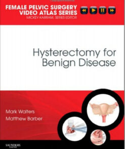 Hysterectomy for Benign Disease: Female Pelvic Surgery Video Atlas Series, 1e (Female Pelvic Video Surgery Atlas Series)
