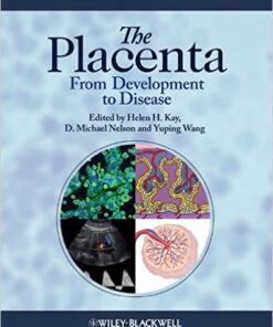 The Placenta: From Development to Disease 1st Edition