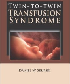 Twin-to-Twin Transfusion Syndrome 1st Edition