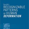 Smith's Recognizable Patterns of Human Deformation, 4e 4th Edition