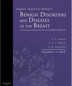 Hughes, Mansel & Webster's Benign Disorders and Diseases of the Breast, 3e 3rd Edition