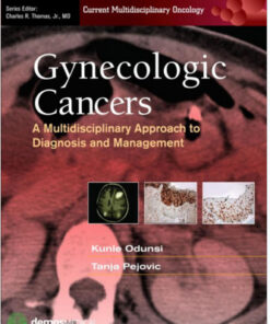 Gynecologic Cancers: A Multidisciplinary Approach to Diagnosis and Management (Current Multidisciplinary Oncology) 1st Edition