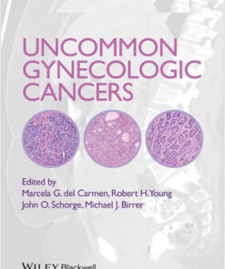 Uncommon Gynecologic Cancers 1st Edition