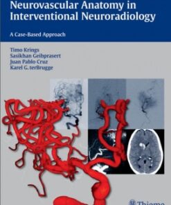 Neurovascular Anatomy in Interventional Neuroradiology: A Case-Based Approach 1e