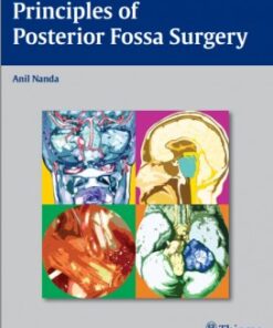 Principles of Posterior Fossa Surgery: Surgical Management 1st edition