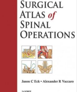 Surgical Atlas of Spinal Operations 1st Edition