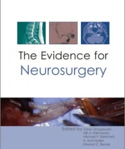 The Evidence for Neurosurgery 1st Edition
