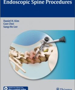 Endoscopic Spine Procedures 1st edition