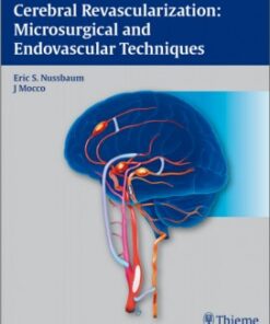 Cerebral Revascularization: Microsurgical and Endovascular Techniques 1st edition