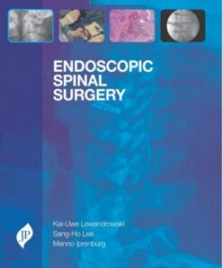 Endoscopic Spinal Surgery 1st Edition
