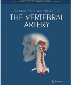 Pathology and surgery around the vertebral artery 2011th Edition