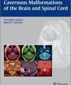 Cavernous Malformations of the Brain and Spinal Cord 1st edition