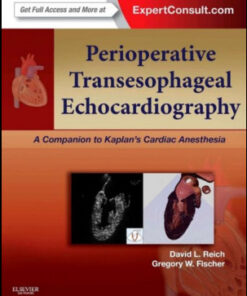 Perioperative Transesophageal Echocardiography: A Companion to Kaplan’s Cardiac Anesthesia
