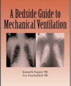 A Bedside Guide To Mechanical Ventilation