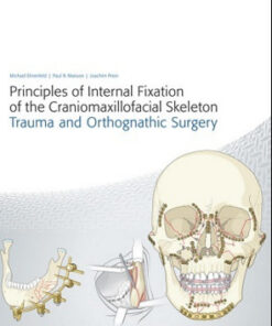 Principles of Internal Fixation of the Craniomaxillofacial Skeleton: Trauma and Orthognathic Surgery