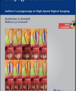 Laryngeal Evaluation: Indirect Laryngoscopy to High-Speed Digital Imaging