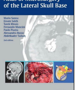 Atlas of Microsurgery of the Lateral Skull Base, 2nd Edition