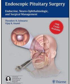 Endoscopic Pituitary Surgery: Endocrine, Neuro-Ophthalmologic and Surgical Management