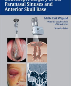 Endoscopic Surgery of the Paranasal Sinuses and Anterior Skull Base, 2nd Edition