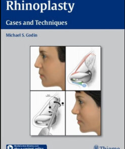 Rhinoplasty: Cases and Techniques