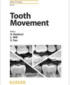 Tooth Movement (Frontiers of Oral Biology, Vol. 18) 1st Edition