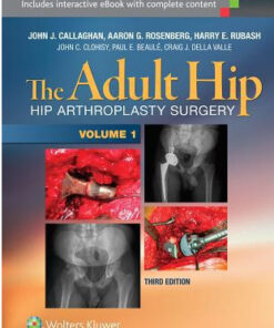 The Adult Hip (Two Volume Set): Hip Arthroplasty Surgery, 3rd Edition