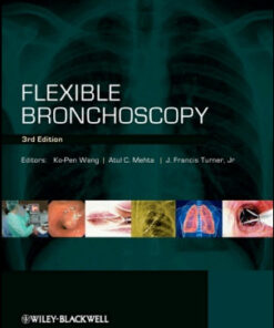 Flexible Bronchoscopy, 3rd Edition
