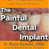 Free The Painful Dental Implant: Patient’s Guide to Peri-Implantitis