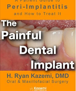 Free The Painful Dental Implant: Patient’s Guide to Peri-Implantitis