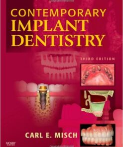 Contemporary Implant Dentistry, 3e 3rd Edition