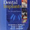Dental Implants: The Art and Science, 2e 2nd Edition