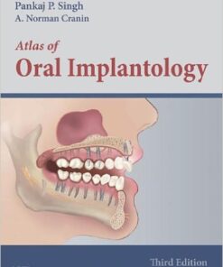 Atlas of Oral Implantology, 3e 3rd Edition