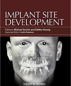 Implant Site Development 1st Edition