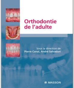 L'implantologie non enfouie (French Edition)