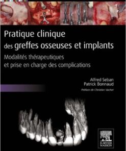 Pratique clinique des greffes osseuses et implants: Modalités thérapeutiques et prise en charge des complications (French Edition)