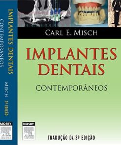 Implantes Dentais Contemporâneos, 3ª Edição