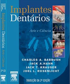 Implantes Dentários. Arte e Ciência (Em Portuguese do Brasil)