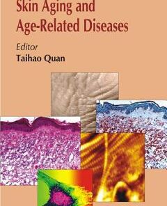 Molecular Mechanisms of Skin Aging and Age-Related Diseases 1st Edition