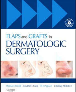Flaps and Grafts in Dermatologic Surgery: Text